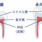 あなたの虫歯はどのレベル？【段階別】主な虫歯の治療法